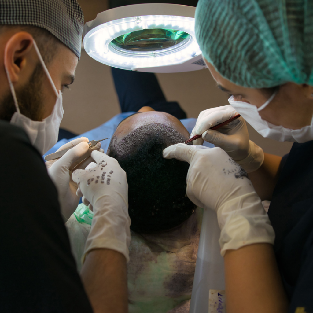 hair transplant